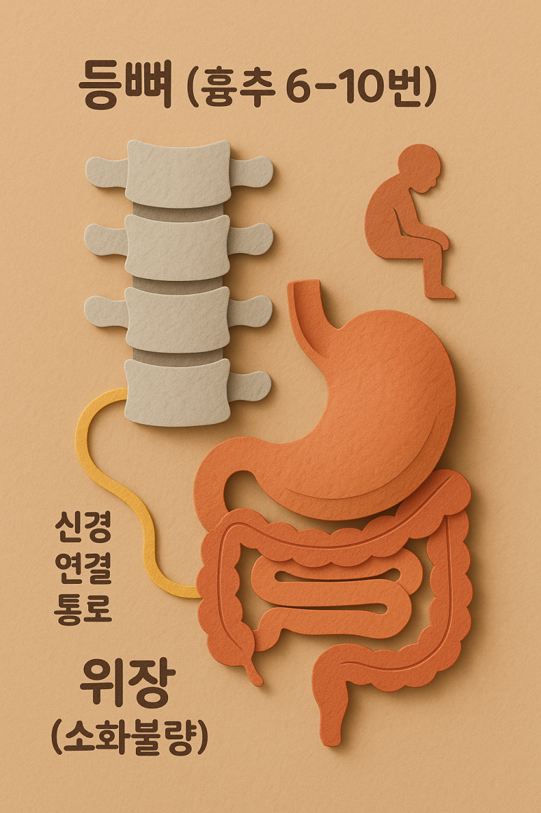 등을 펴면 위장도 펴집니다:  만성 소화불량을 잡는 법