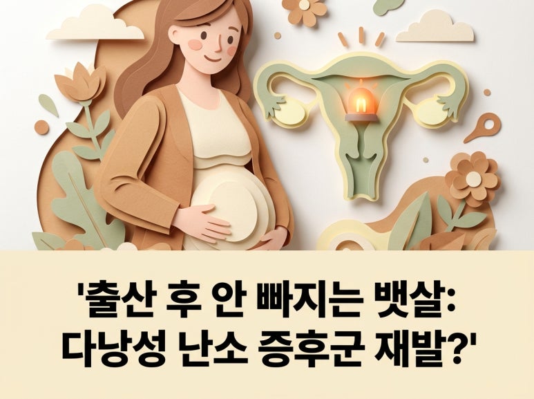 Mỡ bụng không giảm sau sinh, liệu có phải là dấu hiệu tái phát hội chứng buồng trứng đa nang?