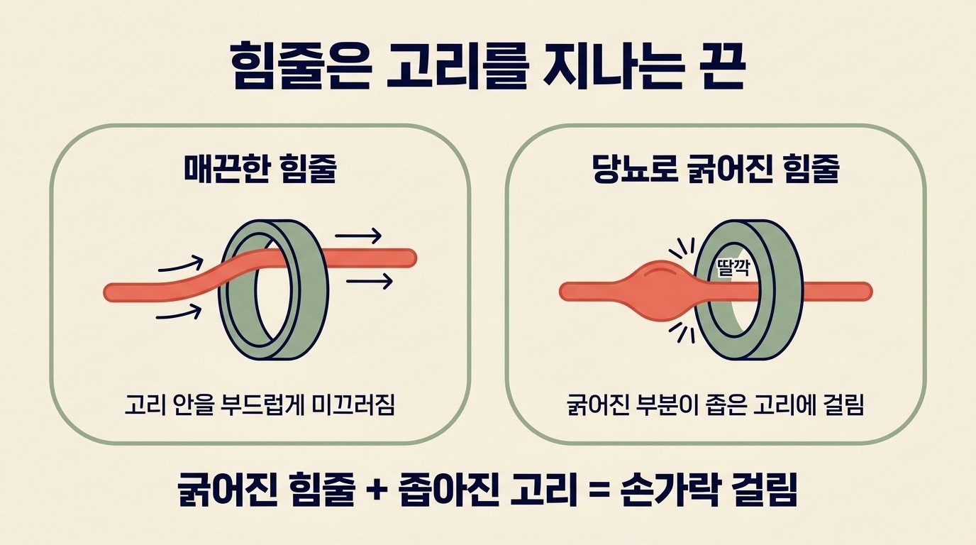 힘줄은 고리를 지나는 끈 — 굵어진 힘줄과 좁아진 고리가 손가락 걸림을 만든다