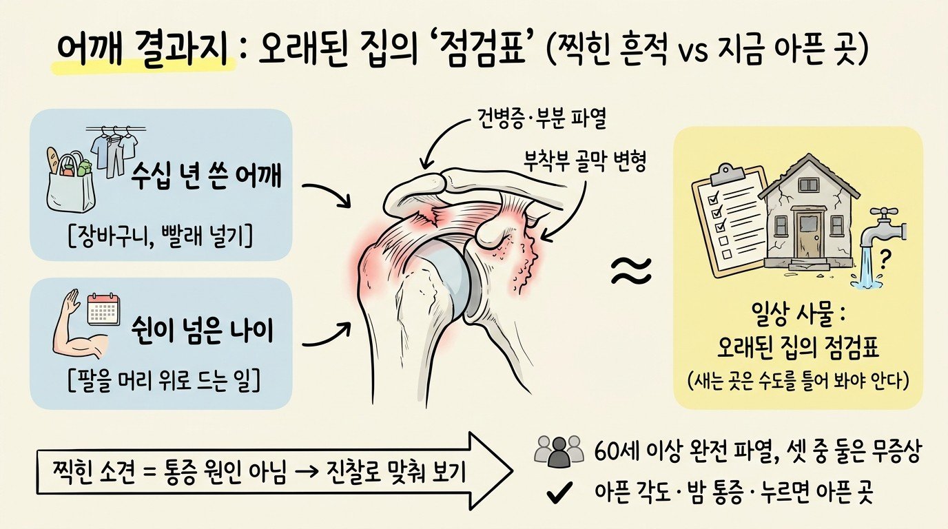 어깨 초음파 결과지를 오래된 집의 점검표에 빗대어, 찍힌 소견이 곧 지금 통증의 원인은 아니며 진찰로 맞춰 봐야 한다는 점을 보여 주는 개념 지도